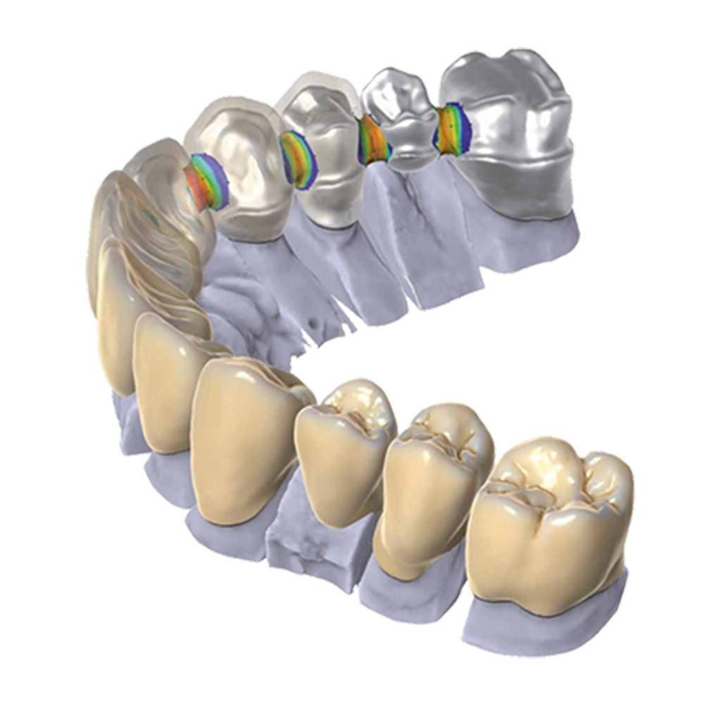 CAD/CAM — bilgisayar destekli tasarım ve üretim