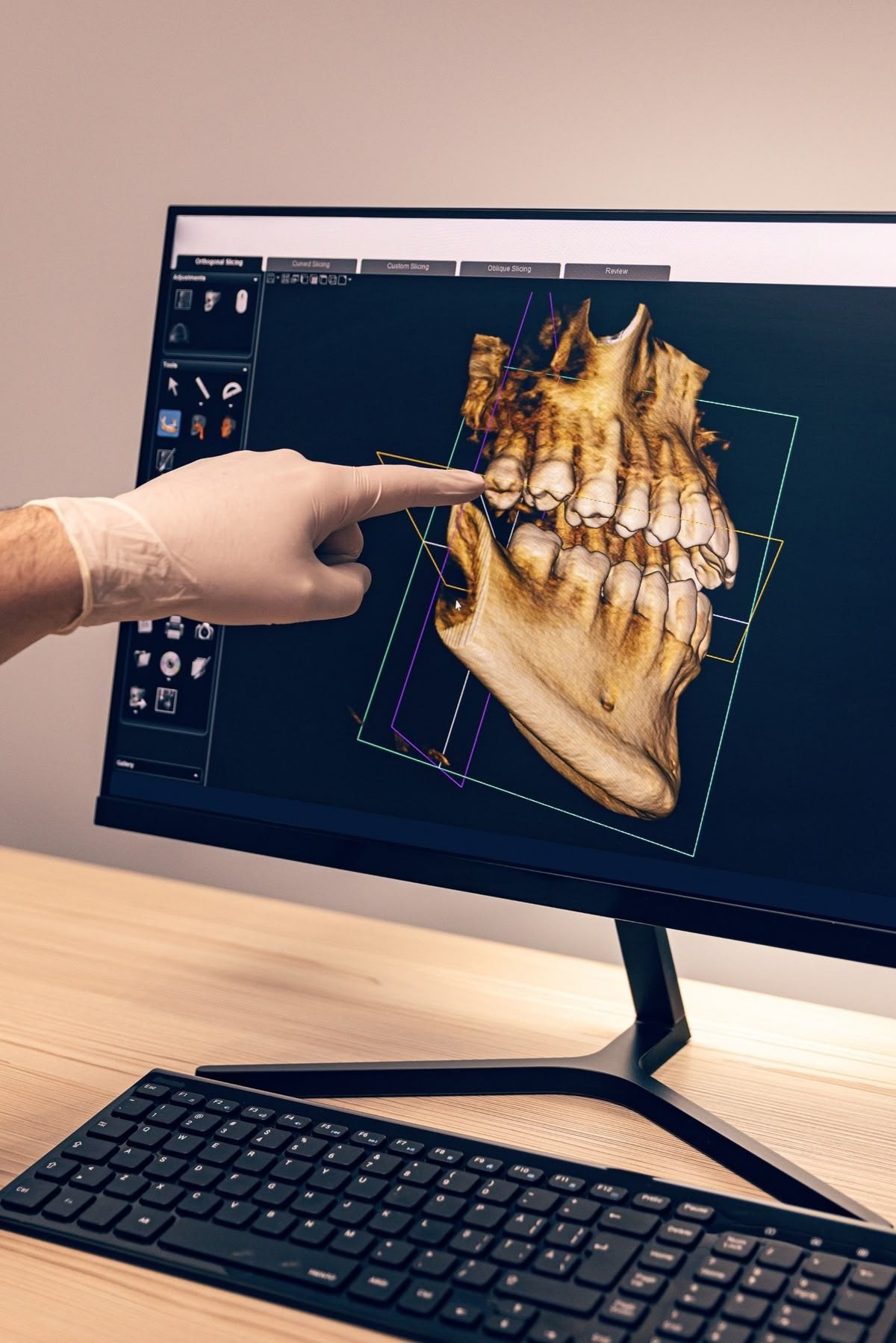 Üç boyutlu çene görüntüsünün ekranda incelenmesi — CBCT