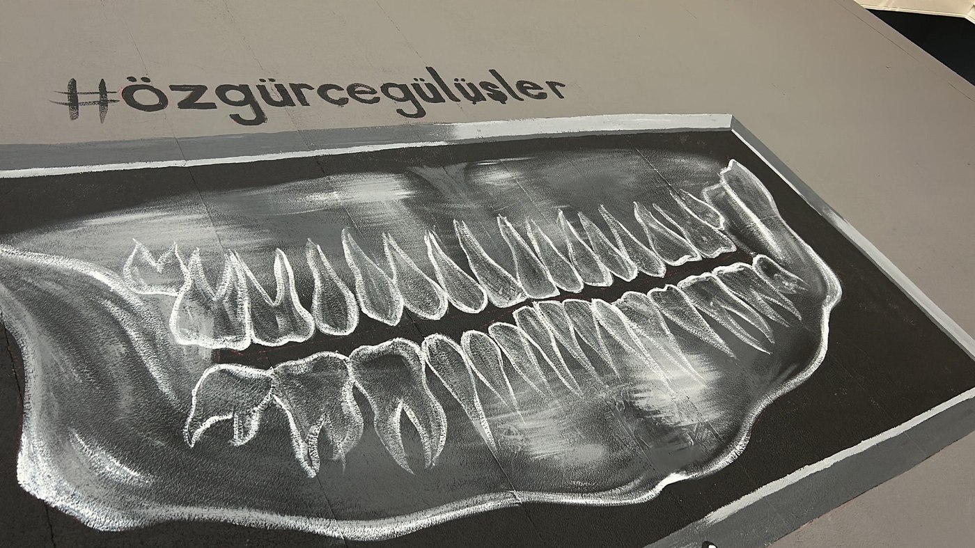 Klinik duvarındaki panoramik röntgen resmi — #özgürcegülüşler